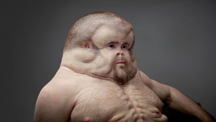 Top 15 Bizarre True Stories